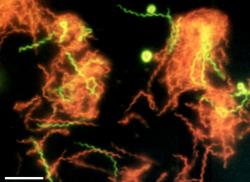 The extremophile bacteria Spirochaeta americana (credit: NASA)