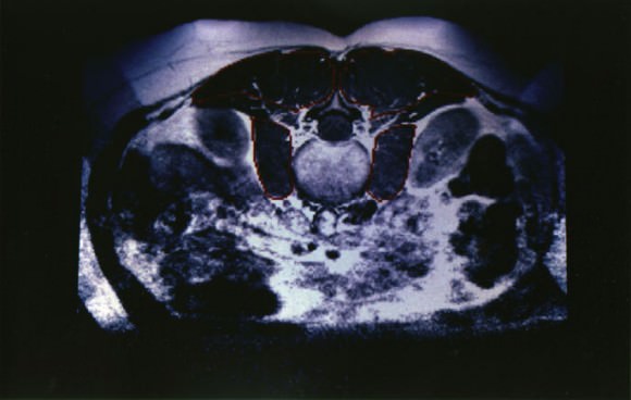 An MRI image of the lower back. Credit: NASA