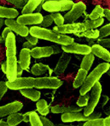 Samples of bacteria Pseudomonas aeruginosa. Credit: NASA