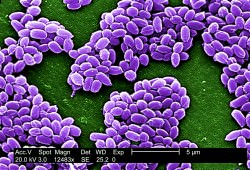 B anthracis bacterial spores. Credit: publicdomainimage.com