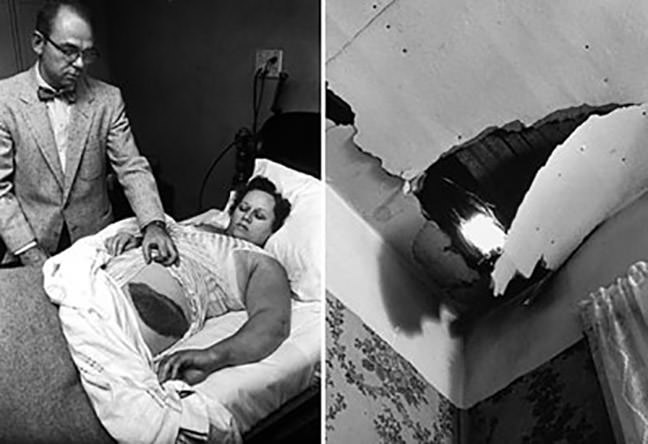 Dr. Moody James shows where Ann Hodges was struck in the hip by an 8.5 lb meteorite that crashed through her roof (right). The photos appeared in the Dec. 13, 1954 issue of Life magazine. Photo by Jay Leviton, Time & Life Pictures, Getty Images
