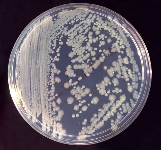 Enterobacter cloacae growing on agar in a petri dish. E. cloacae is not one of the strains found on the ISS, but it does contain some of the same genes and is pathogenic to humans. Image: Public Domain, https://commons.wikimedia.org/w/index.php?curid=1857484