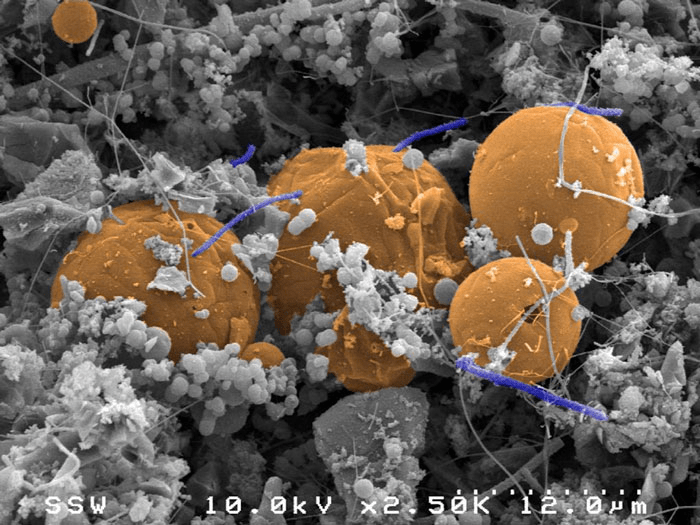 In this image, orange carbon spheres are straddled by purple-blue rod shaped cells named Candidatus Desulforudis. They were found in a fluid and gas-filled fracture 2.8 km beneath Earth’s surface at Mponeng Gold Mine near Johannesburg, South Africa. Surprisingly, they were the only lifeform there, making this deep ecosystem the first found on Earth with only one species. Image Credit: Greg Wanger (California Institute of Technology, USA) and Gordon Southam (The University of Queensland, Australia)