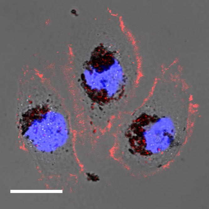 Human cells treated with selenomelanin nanoparticles. Image Credit: 
Northwestern University