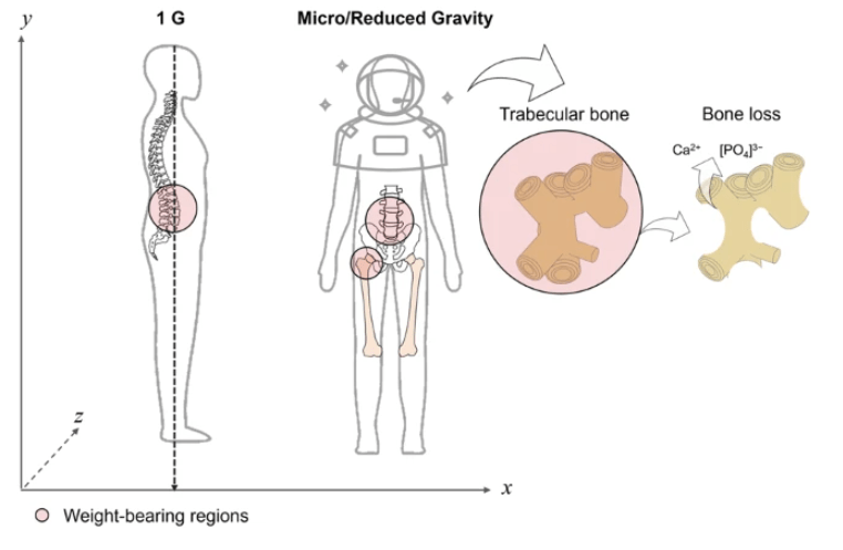 Throughout the extended journey, the absence or reduction in the mechanical forces acting in the anatomical regions most adapted to withstand the gravitational force, such as the hip, femoral head, and lower back vertebrae, will lead to a significant loss of bone minerals in the form of Calcium and Phosphate deposits. Image Credit: Iordachescu et al. 2023
